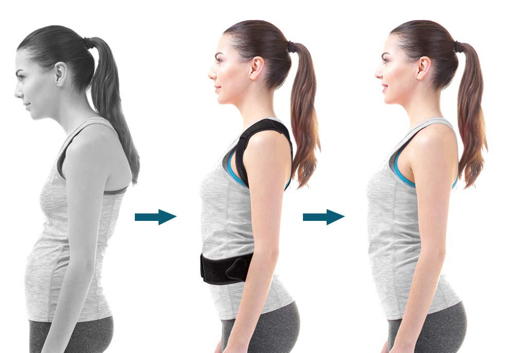 How do Posture Braces Works?